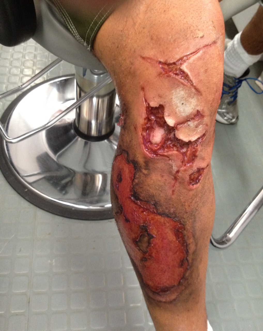 On set of NOAH, Chris' leg after special effects make up.