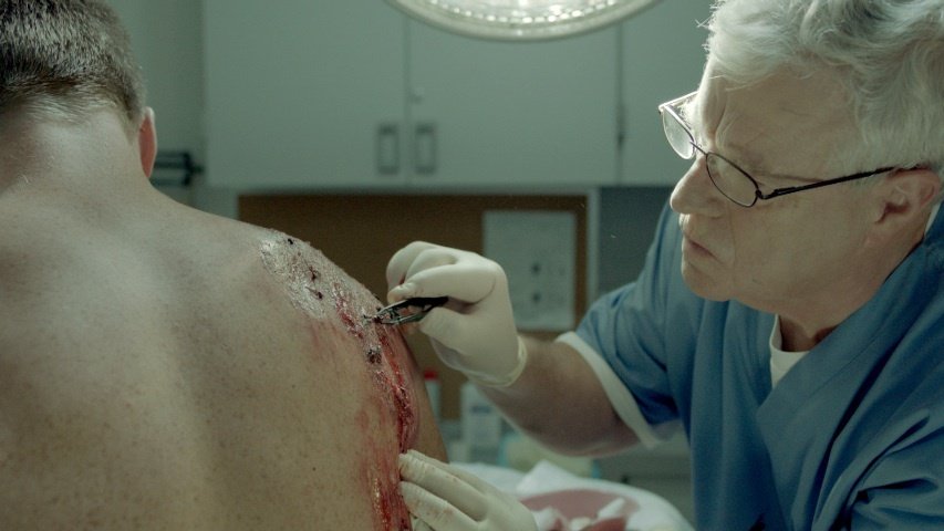 ER Doctor (Christopher Toyne) removes gravel from Johnny (Jared Miller) as yet again his Hog gives him a spill.