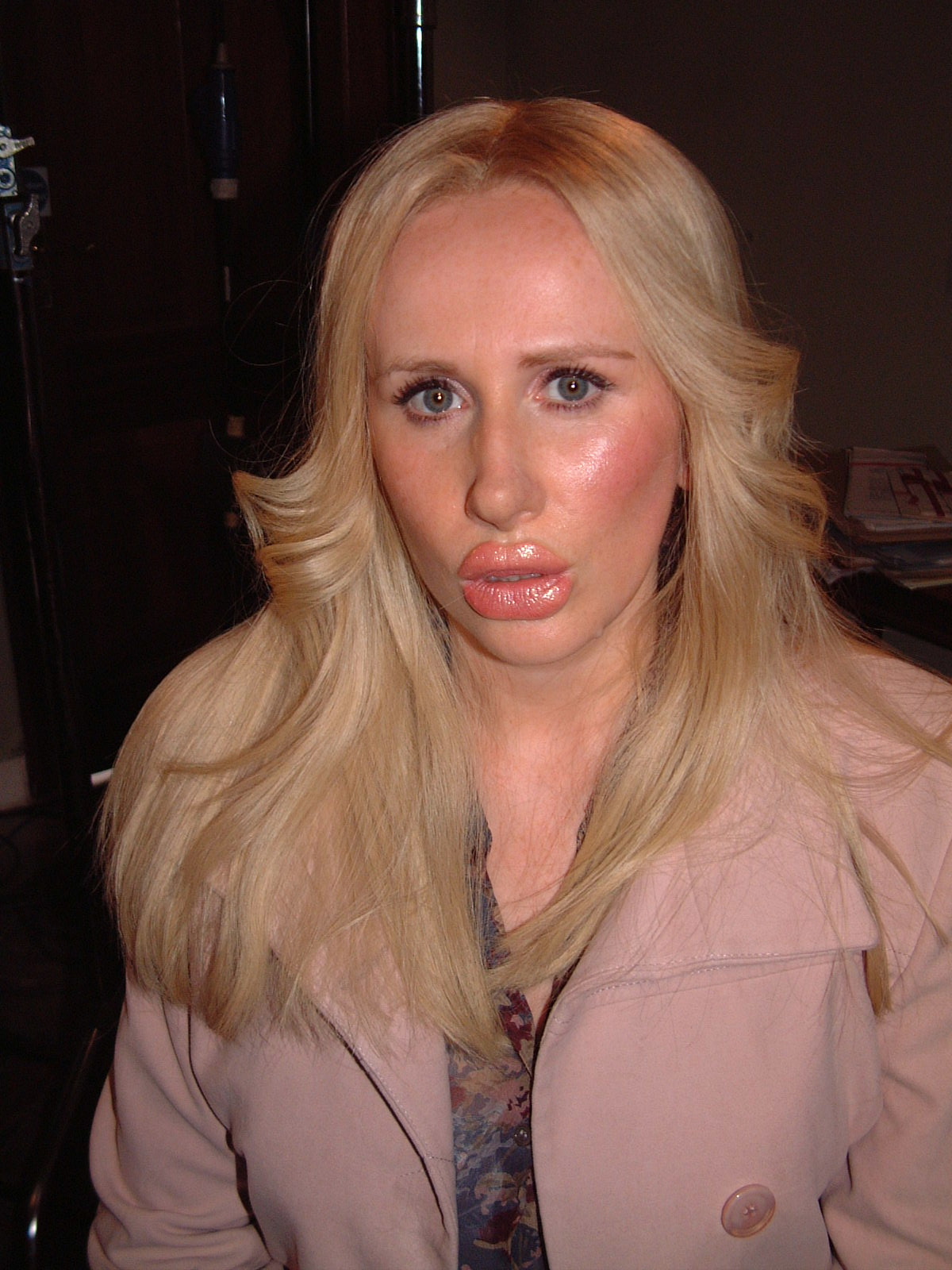 CATHERINE TATE 'HOLLYWOOD ACTRESS AFTER LIP ENHANCEMENT!!!