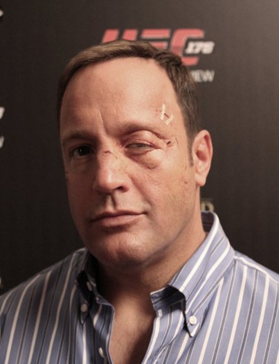 Kevin James in a post fight makeup from Here Comes the Boom. Appliances provided by W.M. Creations