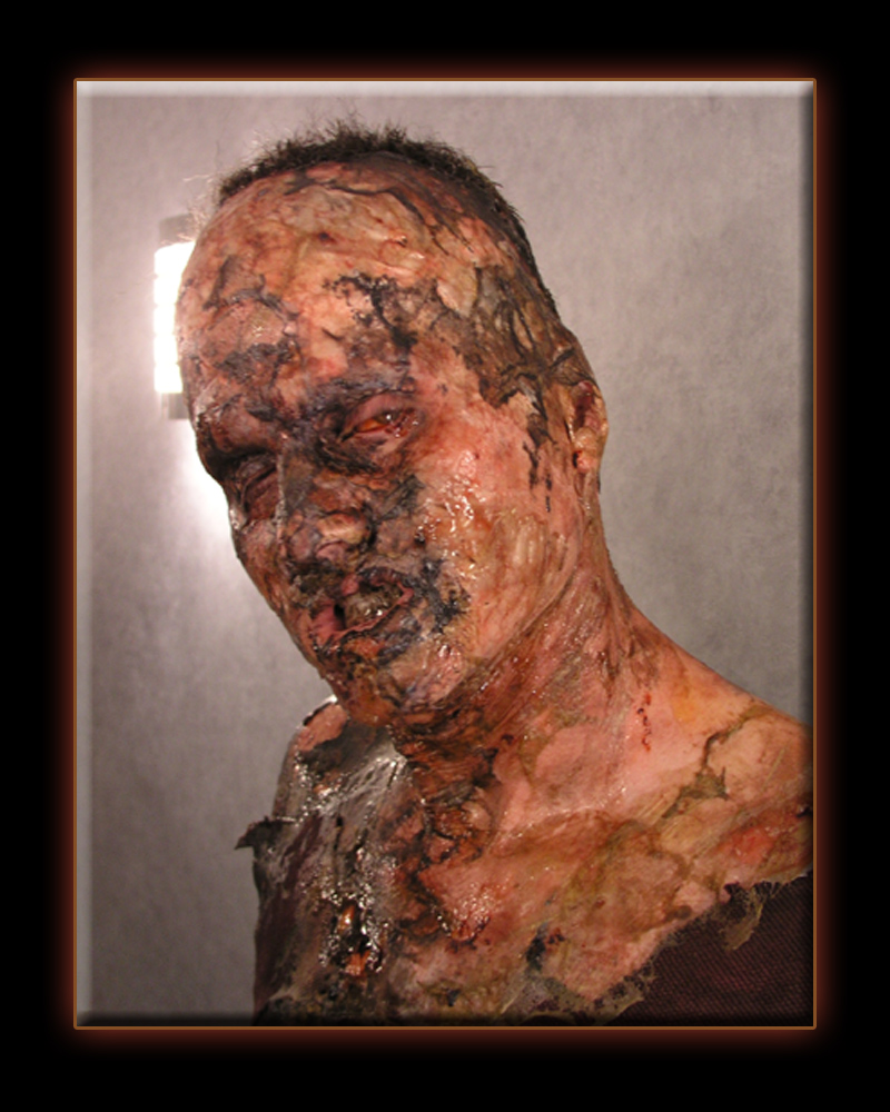 Third degree burn makeup from The Eye. Appliances provided by W.M. Creations