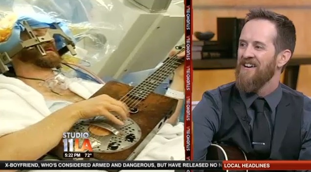 I played guitar during brain surgery and it got world famous. Check it out. http://www.today.com/health/actor-has-brain-surgery-while-awake-strumming-guitar-6C10587302