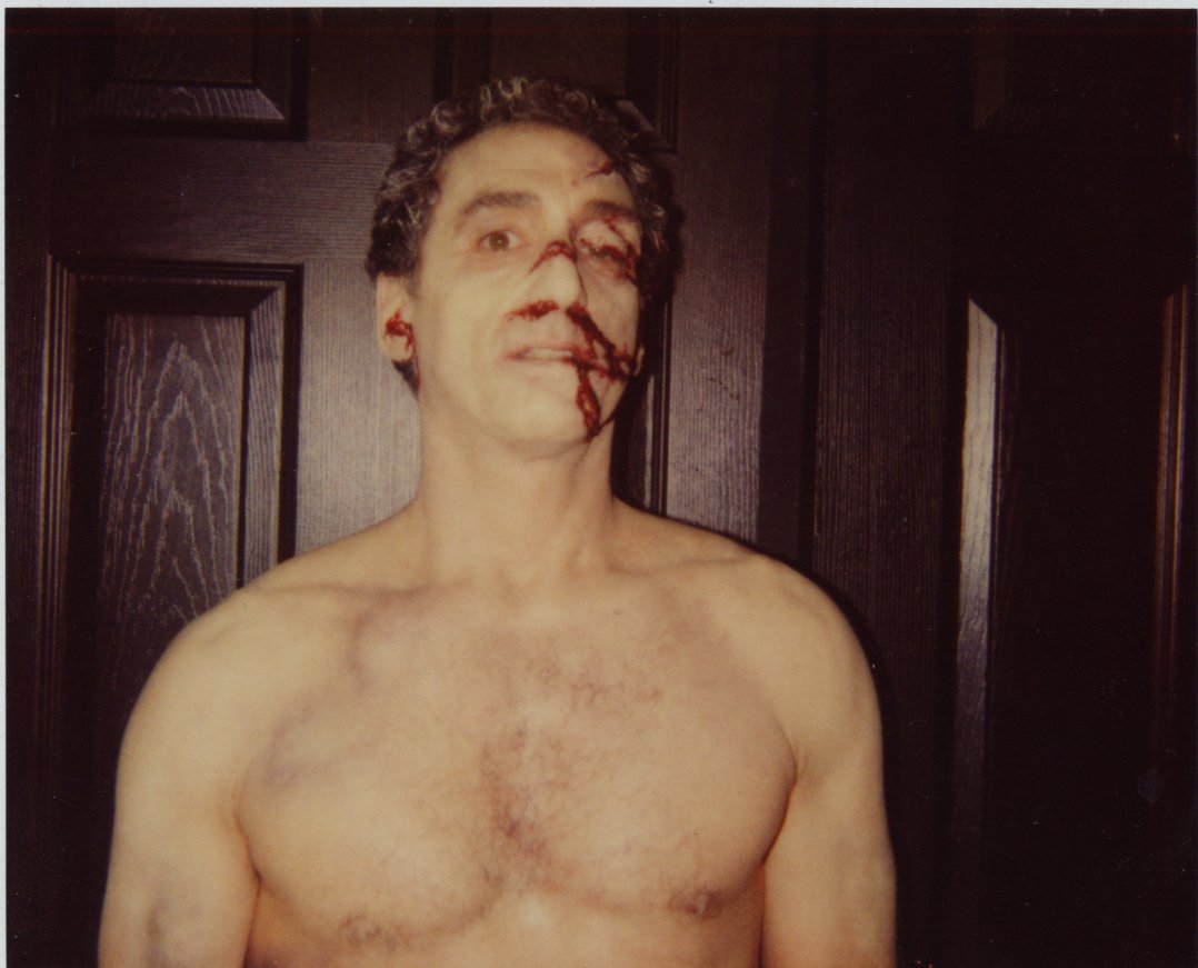David Copeland as Joey Cogo, after just getting a beating on 'The Sopranos'.