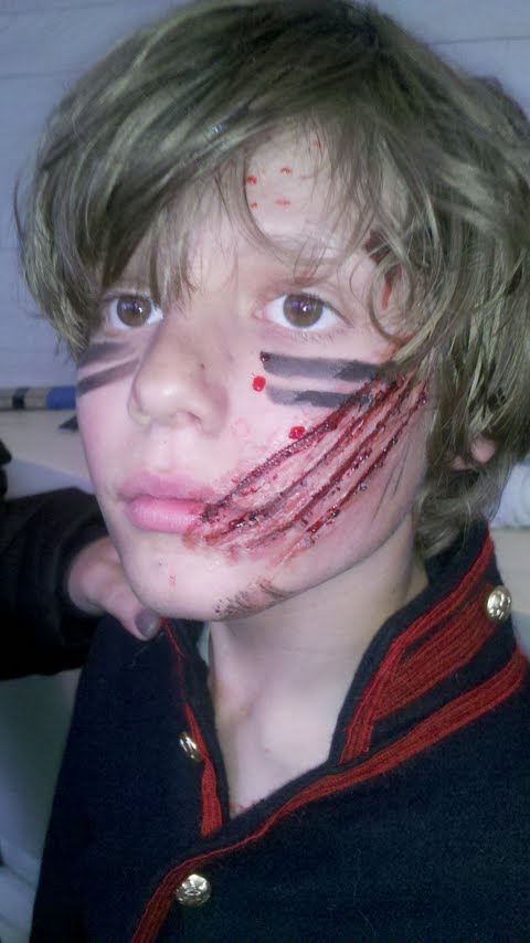 SPFX claw mark on child's face.