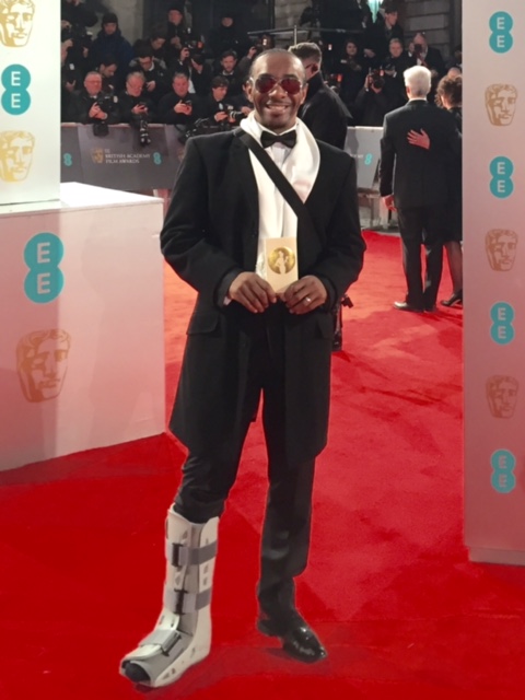 RED CARPET BAFTA FILM AWARDS 2015: BROKEN ANKLE WITH AIR BOOT