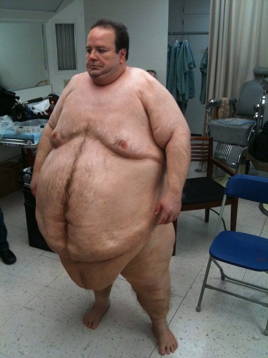Full Body Fat suit with facial prosthetics, Done for Grey's Anatomy.