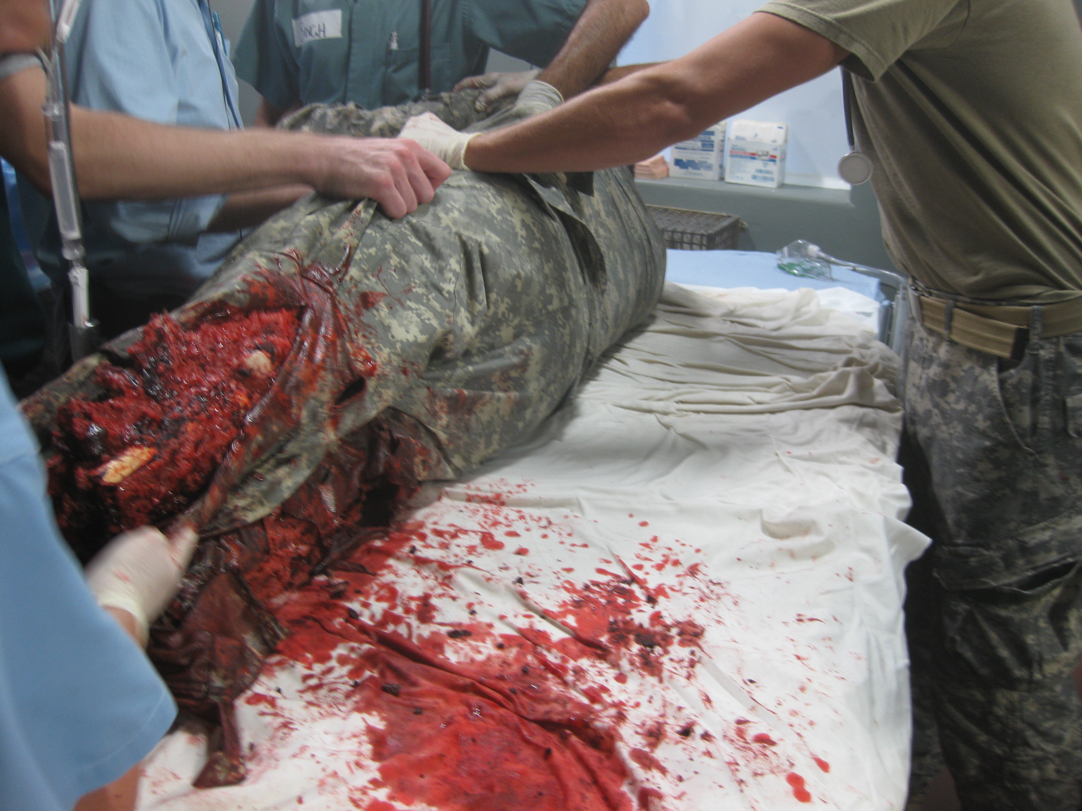 On-set of Untold Stories of The ER - Sept 2011 - Soldier (Hank) rushed to trauma centre afte leg blown off by road side bomb