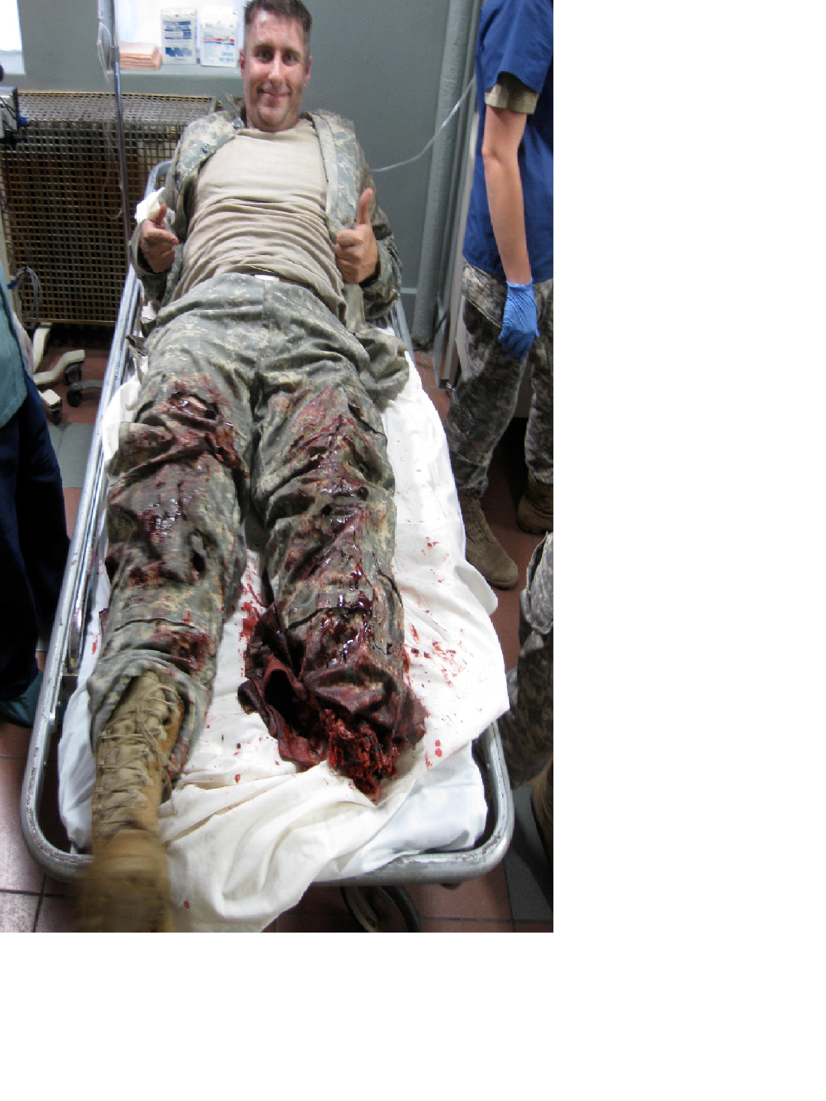 On-set - Untold Stories of The ER - Sept 2012.....Soldier (Hank) rushed to traum unit after leg blownoff by roadside bomb