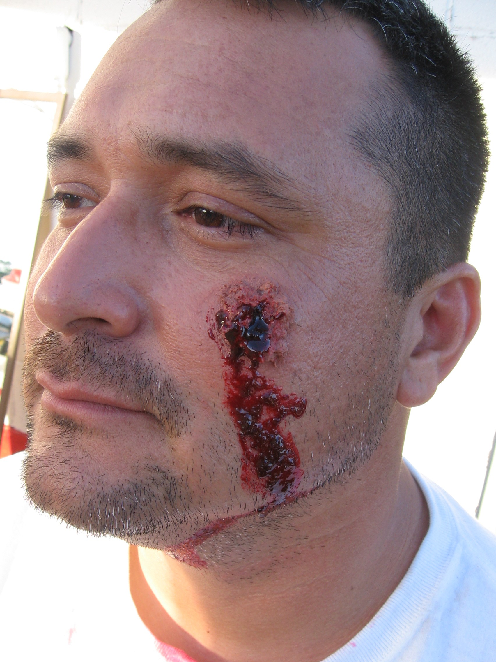 SFX: Bullet wound & blood