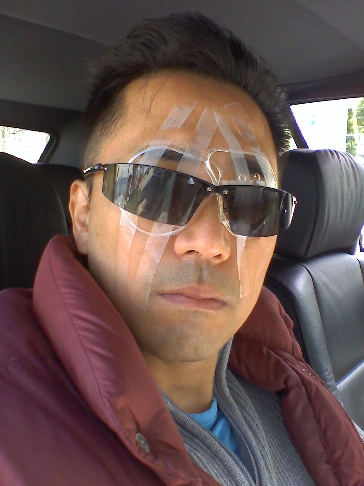 Eiji Mihara Eye Surgery 2008