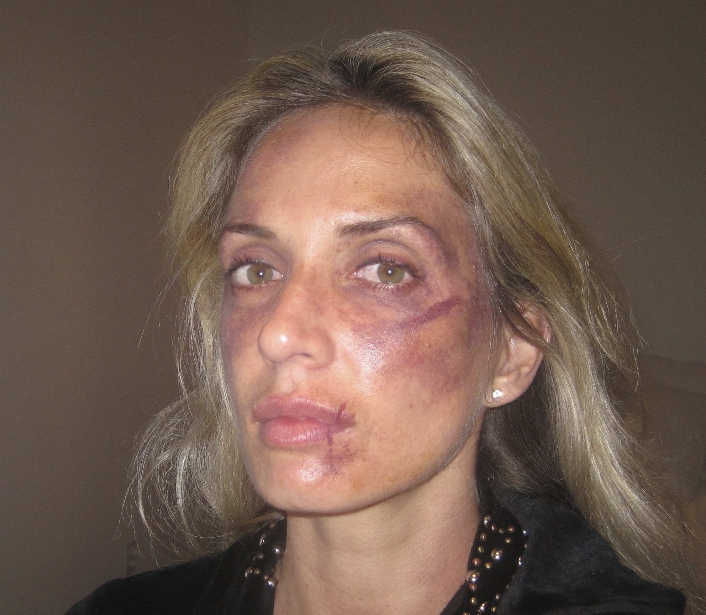 Titles: A Broken Code Names: Eleni Syms Characters: Kate, Still of Eleni Syms in the beat up scene on set, A Broken Code