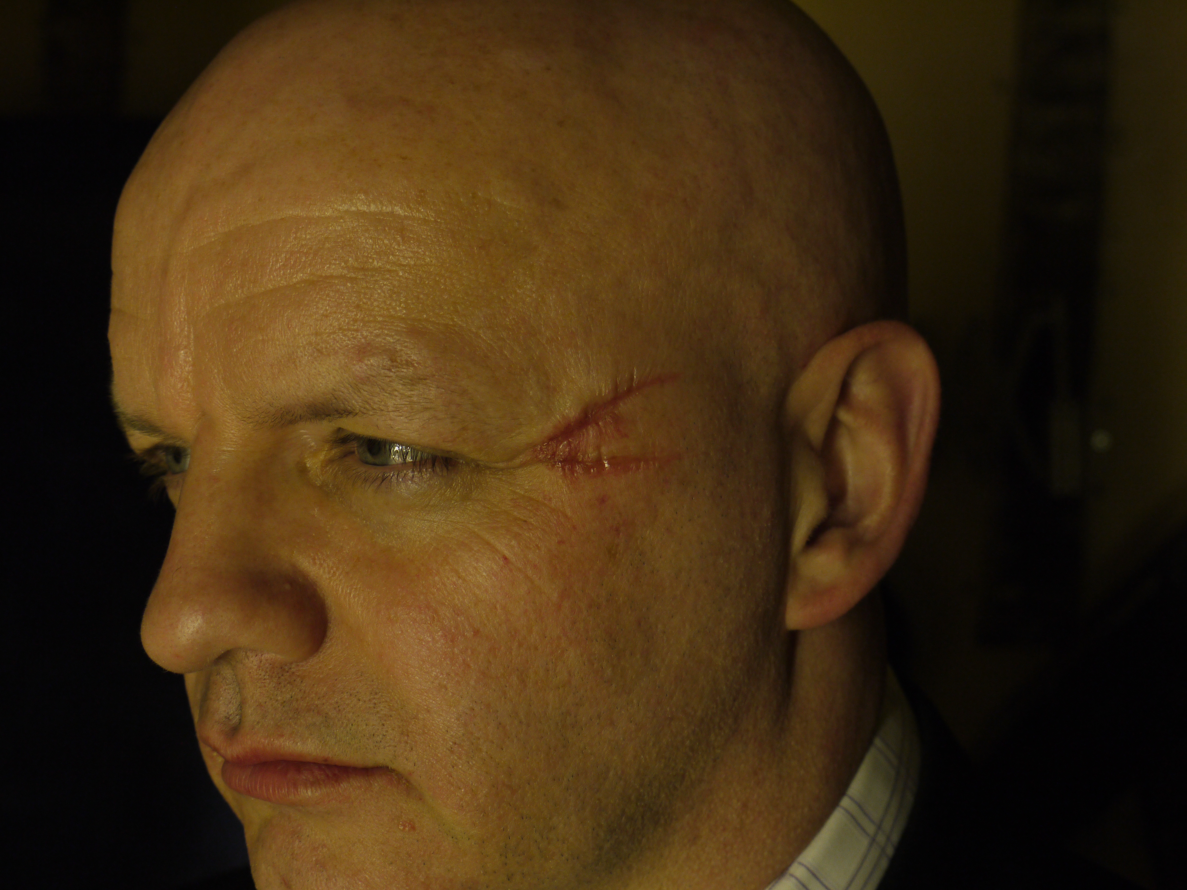 Dr Bell from C.O.O.L.I.O. with his scar