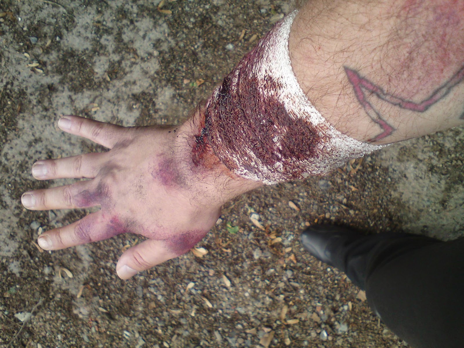 Getting bloody and bruised on an Anthony M Winson photo shoot (2014).