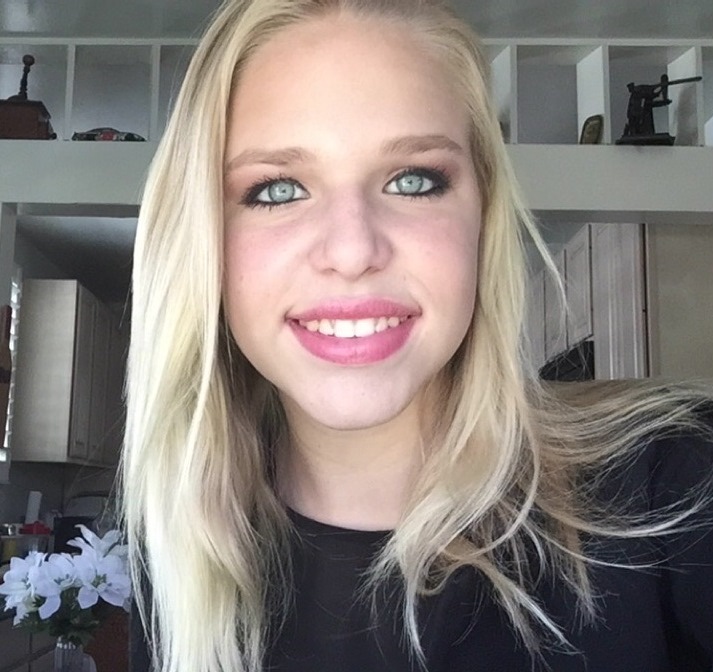 Braces removed in March 2015!