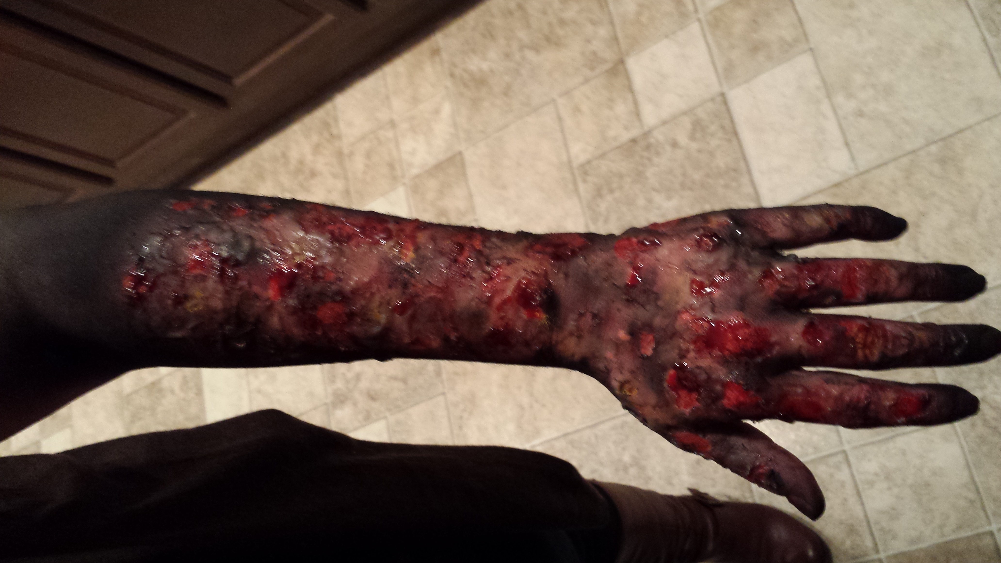 Southern fried homicide 2015 Sfx burnt arm