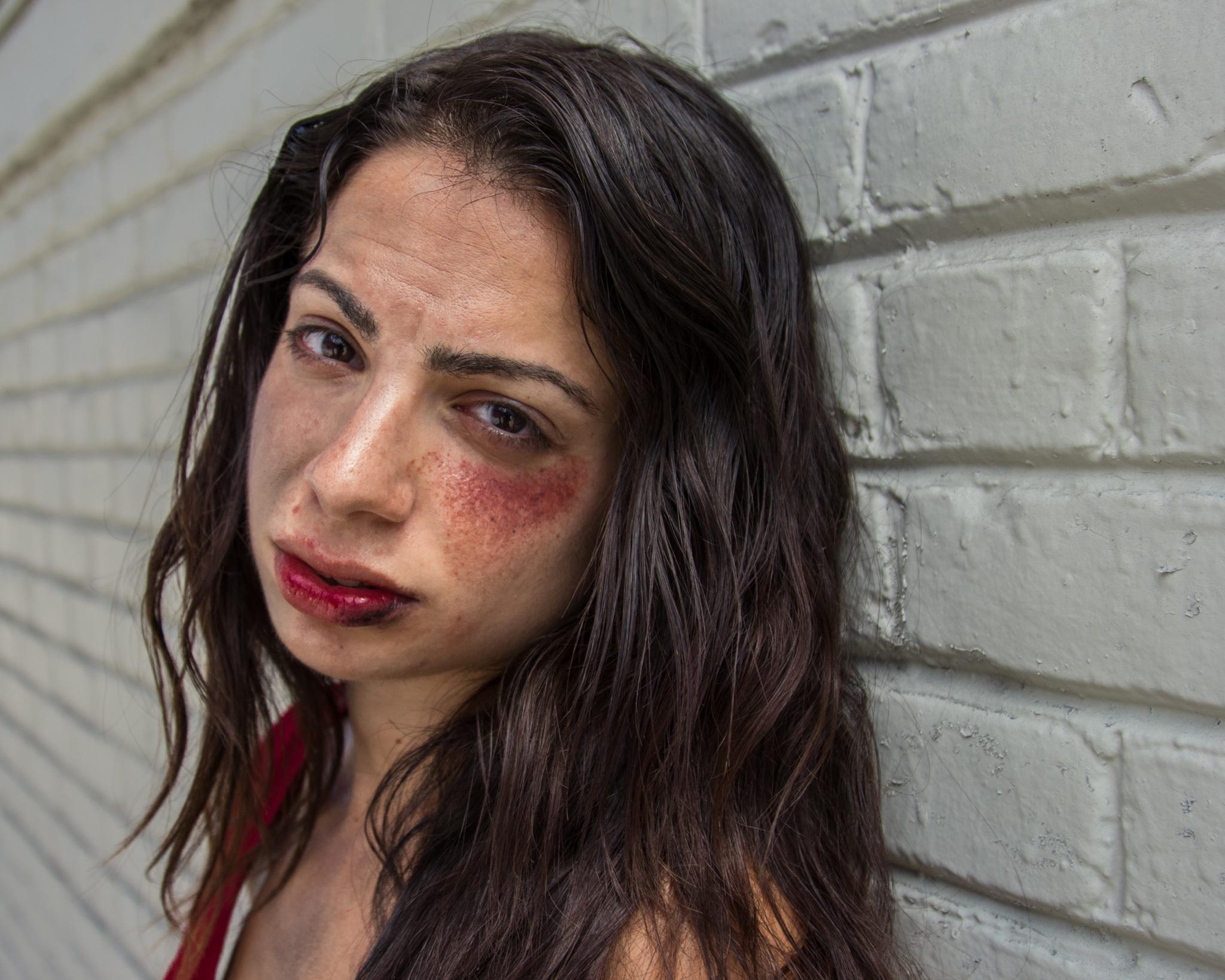 Beat up homeless girl in 