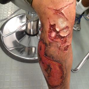 On set of NOAH, Chris' leg after special effects make up.