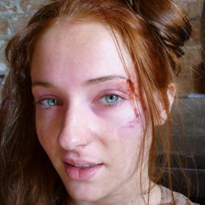 Game Of Thrones  Sansa after being attacked