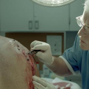 ER Doctor (Christopher Toyne) removes gravel from Johnny (Jared Miller) as yet again his Hog gives him a spill.