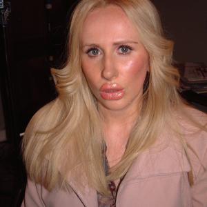 CATHERINE TATE HOLLYWOOD ACTRESS AFTER LIP ENHANCEMENT!!!