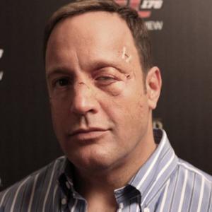 Kevin James in a post fight makeup from Here Comes the Boom. Appliances provided by W.M. Creations