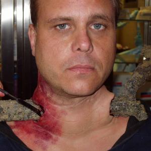 In makeup on the set of Untold Stories of the ER as man with Tree In Neck