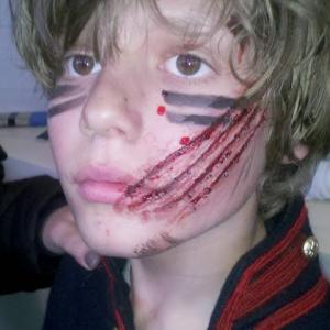 SPFX claw mark on childs face