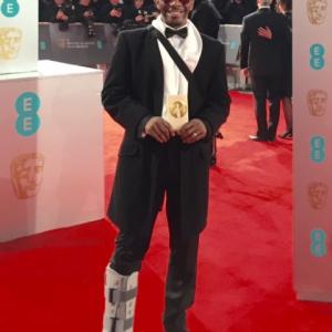 RED CARPET BAFTA FILM AWARDS 2015 BROKEN ANKLE WITH AIR BOOT