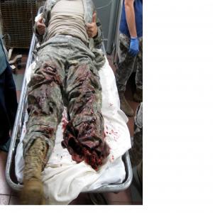 On-set - Untold Stories of The ER - Sept 2012.....Soldier (Hank) rushed to traum unit after leg blownoff by roadside bomb