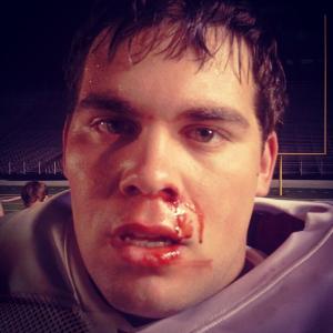 A little busted up on the set of Greater as Brandon Burlsworth