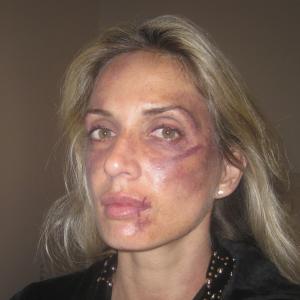 Titles: A Broken Code Names: Eleni Syms Characters: Kate, Still of Eleni Syms in the beat up scene on set, A Broken Code