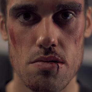 Ouch. Production still of 
