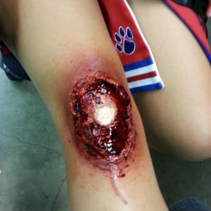 Zombie Knee in Alive and Unburied Makeup by Steve Kwiatkowski.