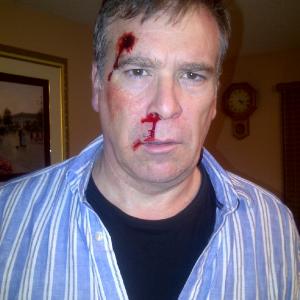 Badly Beaten Dad in 