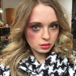 Bruises Domestic Violence Scene