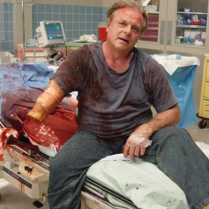 CoStar Nip Tuck Building Contractor hit by flying power saw blade ER scene